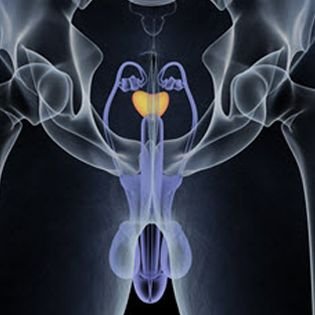 Prostate Diseases